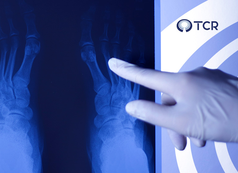 Por que a radiografia digital é mais segura para a sua saúde?