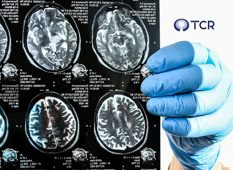 Por que os exames de imagem são importantes para o diagnóstico precoce de doenças?